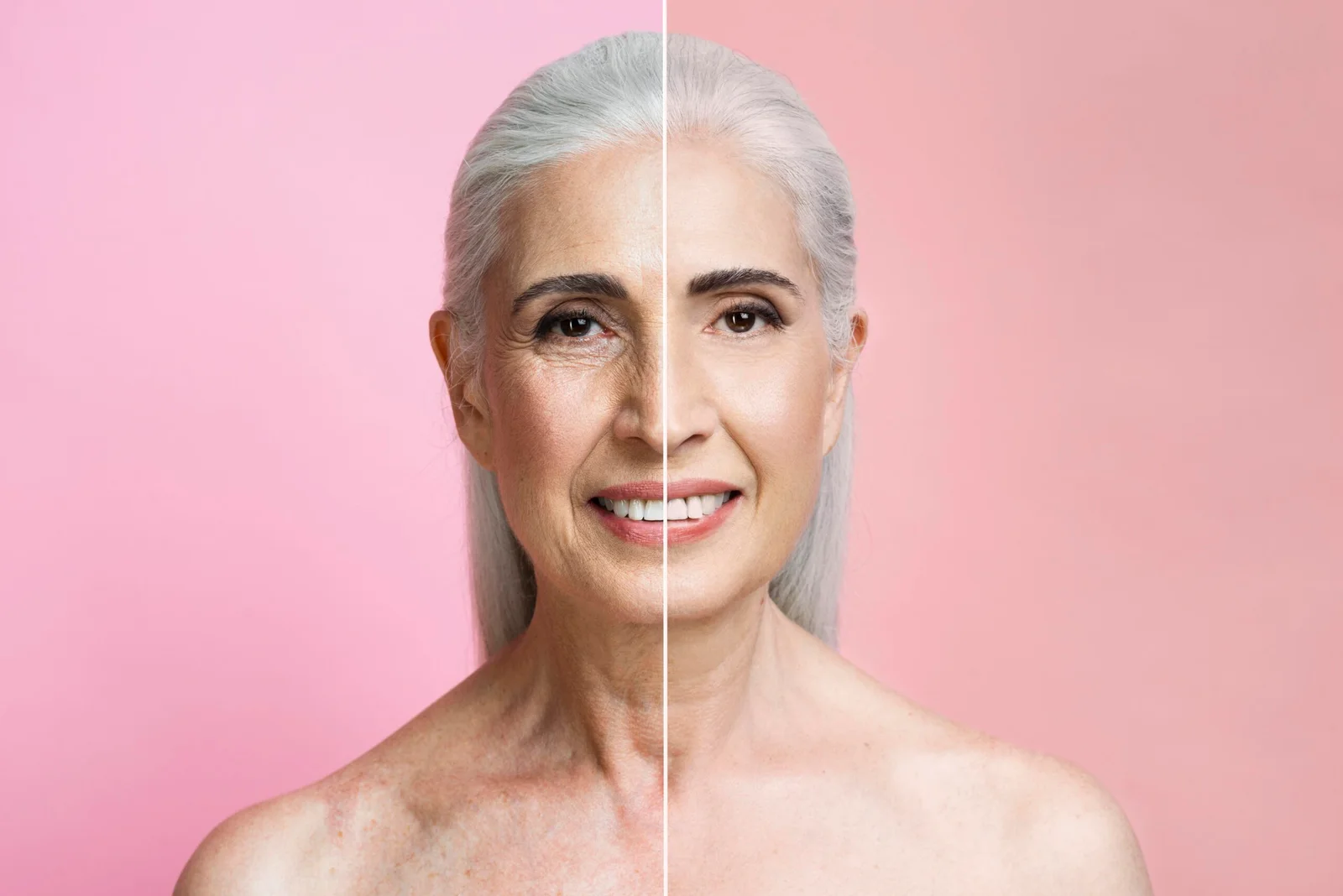 Renove seu Rosto Facelift