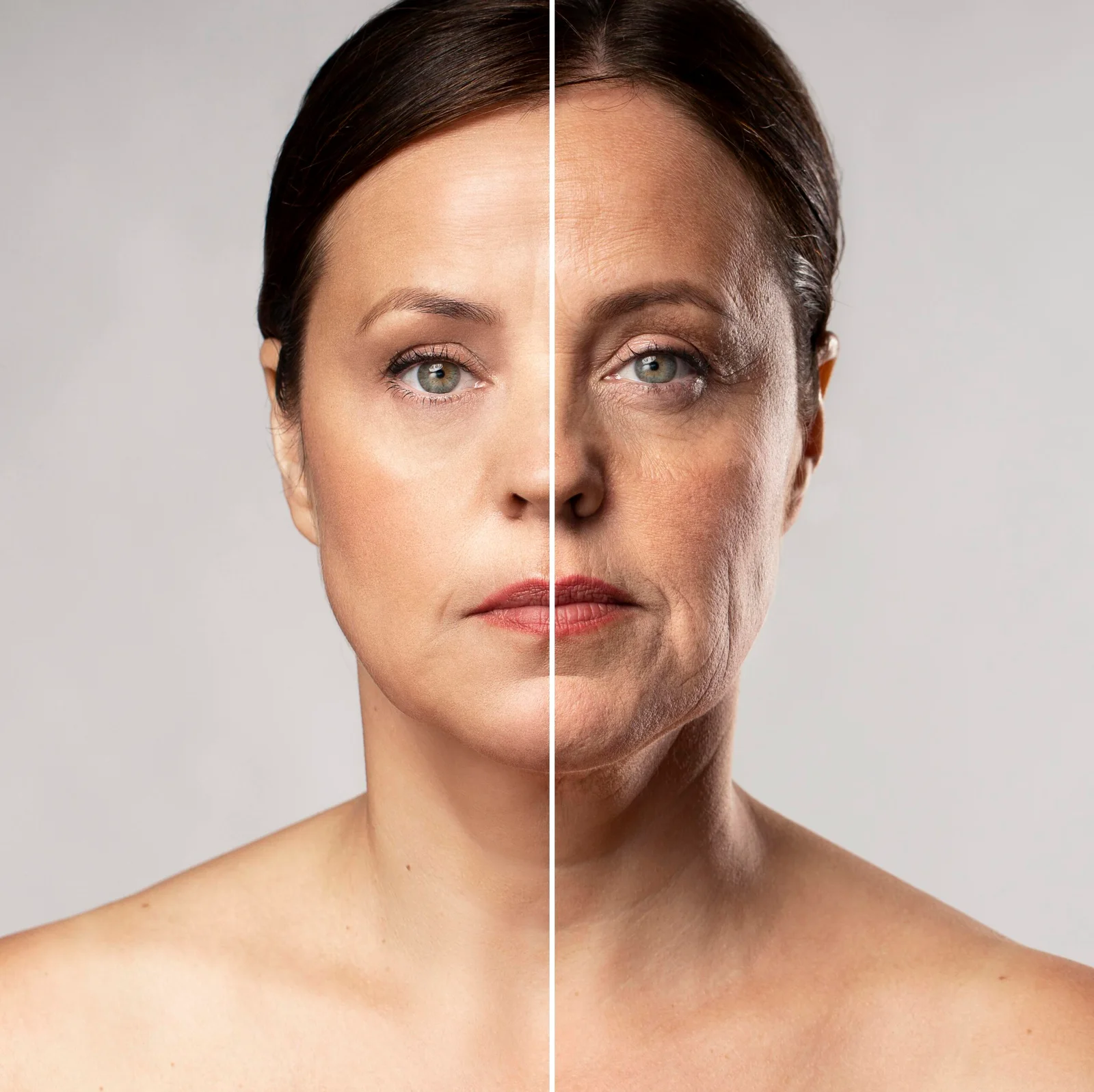 Botox